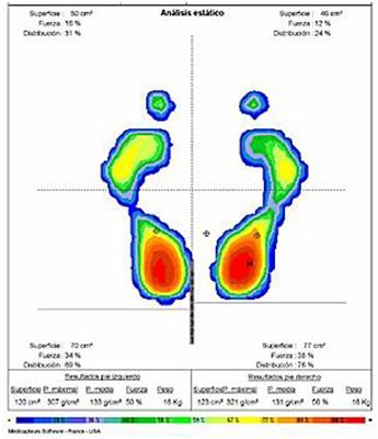 Dental Malocclusion and Its Relation to the Podal System